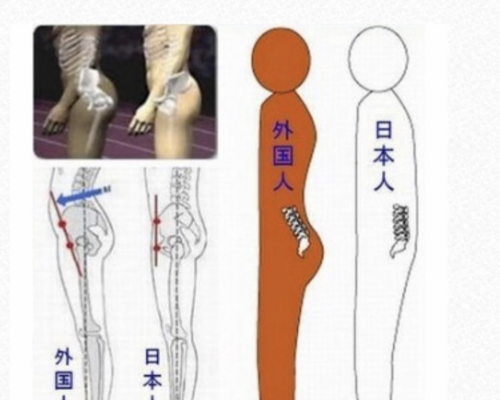 骨格